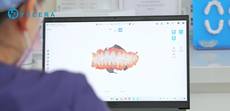 Escáner intraoral YRC-S03 - foto 4