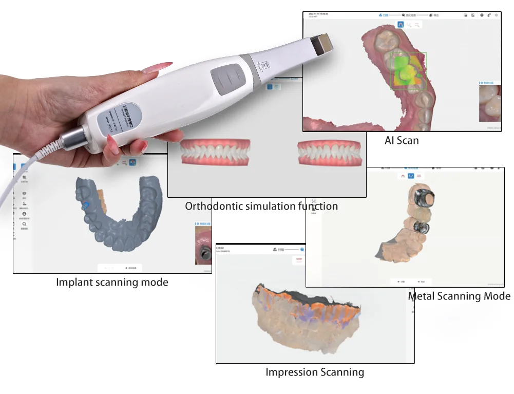 Escáner intraoral YRC-S03 - foto 3