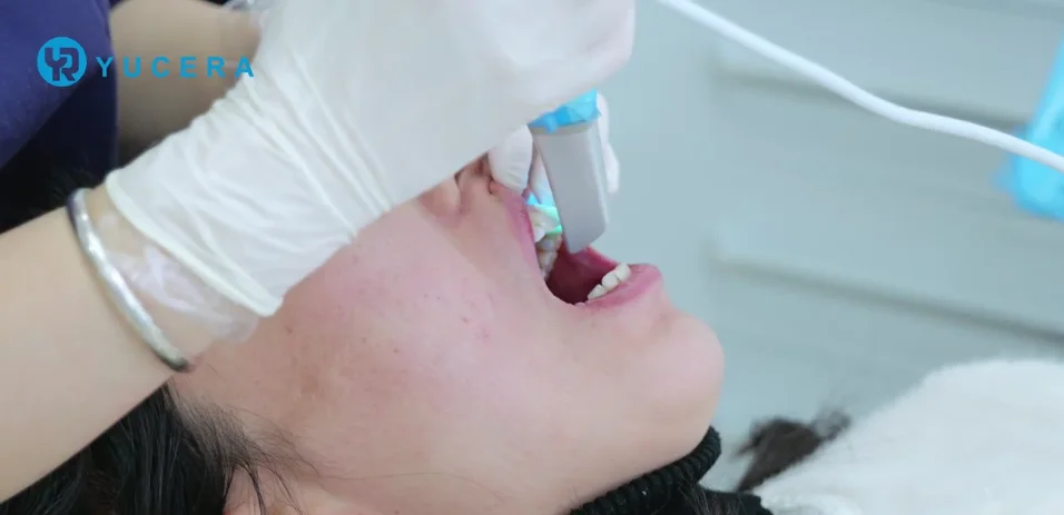 Escáner intraoral YRC-S03 - foto 5